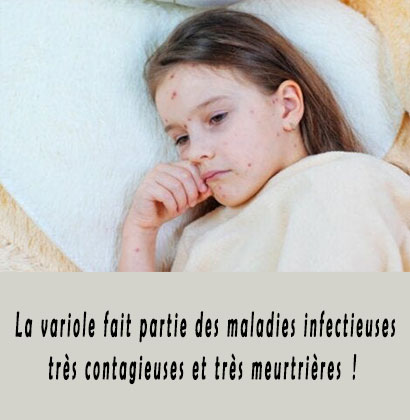 La variole fait partie des maladies infectieuses très contagieuses et très meurtrières !