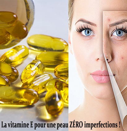 La vitamine E pour une peau ZÉRO imperfections ! La vitamine E pour une peau ZÉRO imperfections !