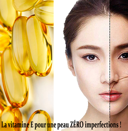 La vitamine E pour une peau ZÉRO imperfections ! La vitamine E pour une peau ZÉRO imperfections !