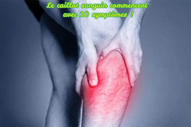La Caillot sanguin commencent avec les symptômes Le caillot sanguin commencent avec 10 symptômes !