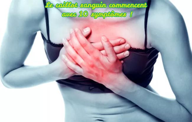 Le caillot sanguin commencent avec 10 symptômes !