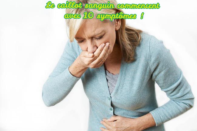Le caillot sanguin Le caillot sanguin commencent avec 10 symptômes !