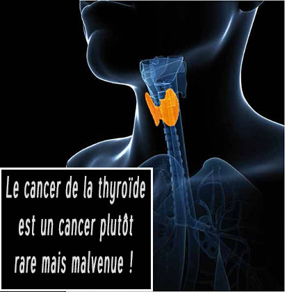 Le cancer de la thyroïde est un cancer plutôt rare mais malvenue !