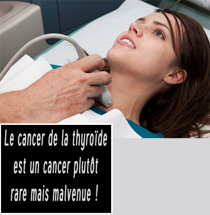 Le cancer de la thyroïde est un cancer plutôt rare mais malvenue !