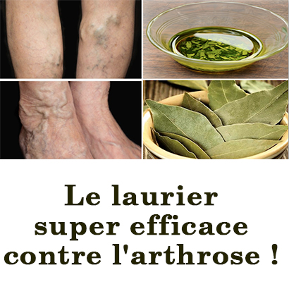 Le laurier super efficace contre l'arthrose ! Le laurier super efficace contre l'arthrose !
