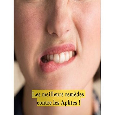 Les meilleurs remèdes contre les Aphtes !