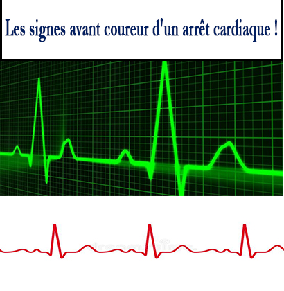 Les signes avant coureur d'un arrêt cardiaque ! Les signes avant coureur d'un arrêt cardiaque !