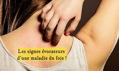 Les signes évocateurs d’une maladie du foie !