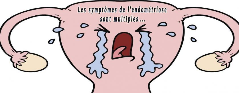 Les symptômes de l’endométriose sont multiples ... 