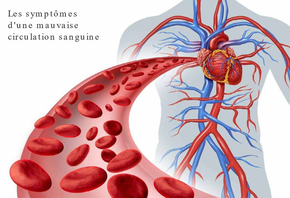 Les symptômes d'une mauvaise circulation sanguine Les symptômes d'une mauvaise circulation sanguine