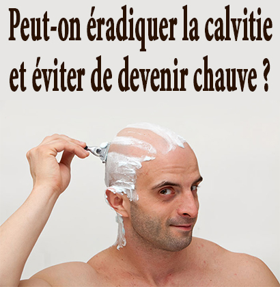 Peut-on éradiquer la calvitie et éviter de devenir chauve ?