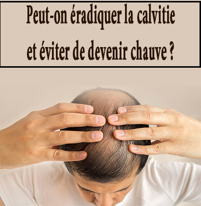 Peut-on éradiquer la calvitie et éviter de devenir chauve ?