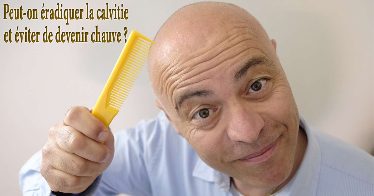 Peuton éradiquer la calvitie et éviter de devenir chauve — free download