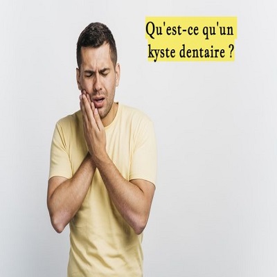 Qu'est-ce qu'un kyste dentaire ?