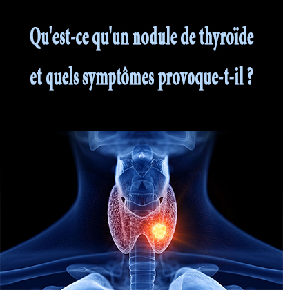 Qu'est-ce qu'un nodule de thyroïde et quels symptômes provoque-t-il ? 