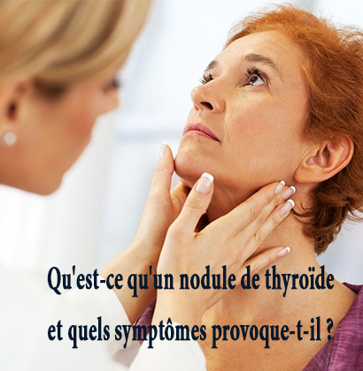 Qu'est-ce qu'un nodule de thyroïde et quels symptômes provoque-t-il ? 