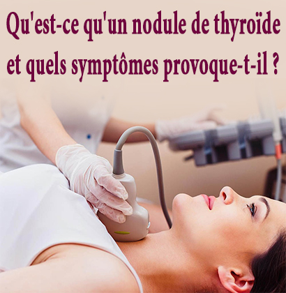 Qu'est-ce qu'un nodule de thyroïde et quels symptômes provoque-t-il ? 