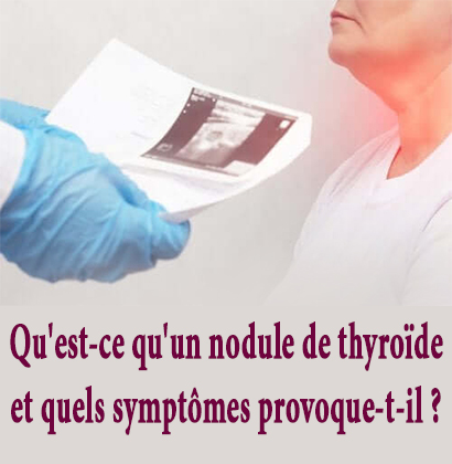 Qu'est-ce qu'un nodule de thyroïde et quels symptômes provoque-t-il ? 