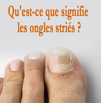 Qu'est-ce que signifie les ongles striés ?