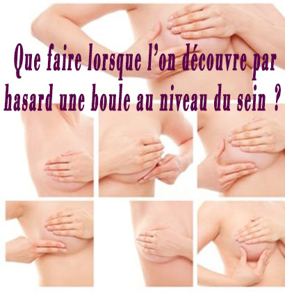 Que faire lorsque l’on découvre par hasard une boule au niveau du sein ?