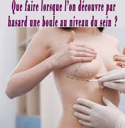 Que faire lorsque l’on découvre par hasard une boule au niveau du sein ?