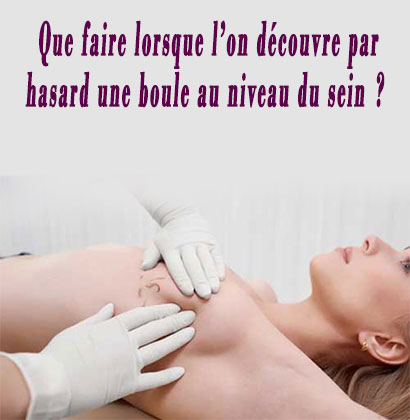 Que faire lorsque l’on découvre par hasard une boule au niveau du sein ?