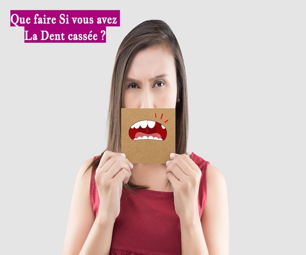Que faire Si vous avez La Dent cassée ?