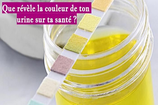 Que révèle la couleur de ton urine sur ta santé ?