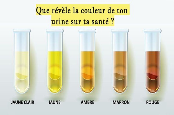 Que révèle la couleur de ton urine sur ta santé ?