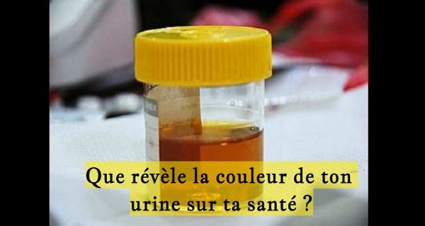 Que révèle la couleur de ton urine sur ta santé ?