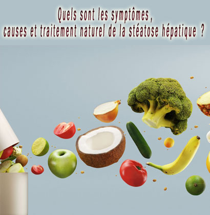 Quels sont les symptômes, causes et traitement naturel de la stéatose hépatique ?