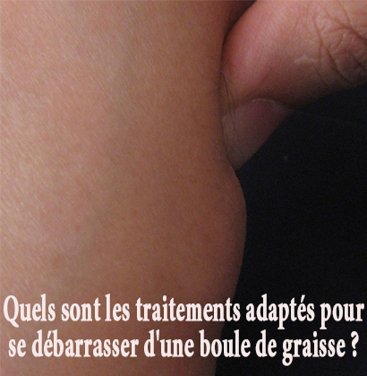 Quels sont les traitements adaptés pour se débarrasser d'une boule de graisse ? Quels sont les traitements adaptés pour se débarrasser d'une boule de graisse ?
