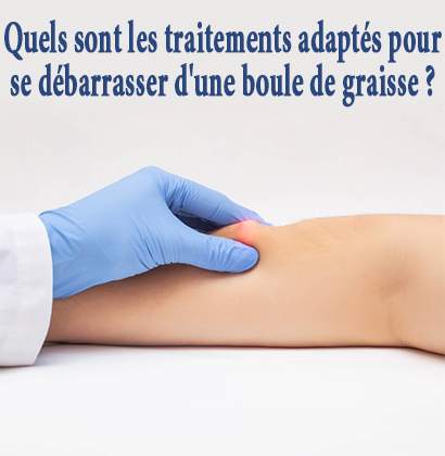 Quels sont les traitements adaptés pour se débarrasser d'une boule de graisse ? Quels sont les traitements adaptés pour se débarrasser d'une boule de graisse ?