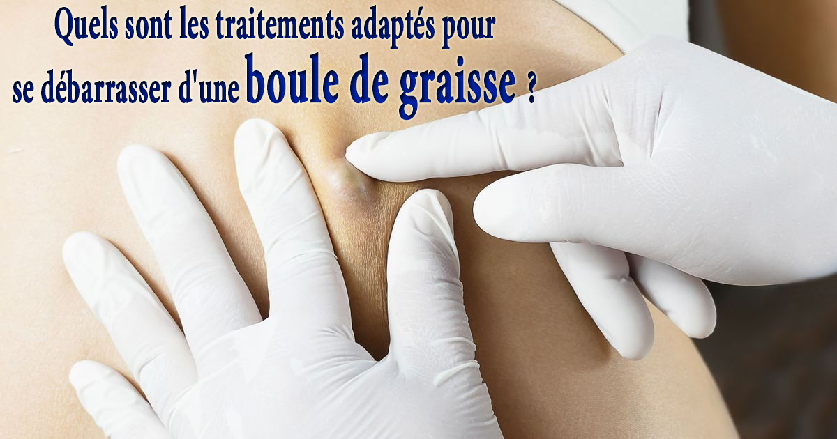 Quels sont les traitements adaptés pour se débarrasser d'une boule de