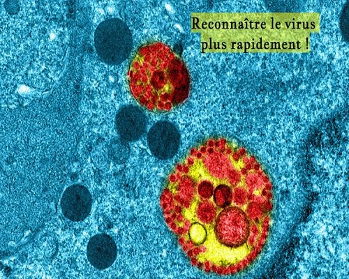 images/reconnaitre-le-virus-plus-rapidement01.jpg Reconnaître le virus plus rapidement !
