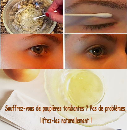 Souffrez-vous de paupières tombantes ? Pas de problèmes, liftez-les naturellement ! Souffrez-vous de paupières tombantes ? Pas de problèmes, liftez-les naturellement !