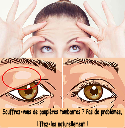 Souffrez-vous de paupières tombantes ? Pas de problèmes, liftez-les naturellement ! Souffrez-vous de paupières tombantes ? Pas de problèmes, liftez-les naturellement !