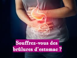 Souffrez-vous des brûlures d’estomac ?