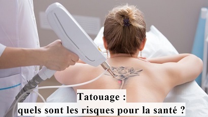 Tatouage : quels sont les risques pour la santé ?