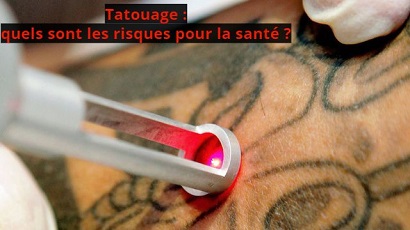 Tatouage : quels sont les risques pour la santé ?