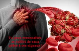 Un caillot de sang, aussi connu sous le nom d’embolie, est une masse gélatineuse qui bloque une artère ou une veine.