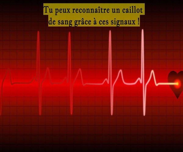 Tu peux reconnaître un caillot de sang grâce à ces signaux !