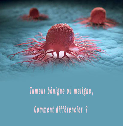 Tumeur bénigne ou maligne, Comment différencier ?