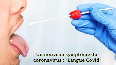 Un nouveau symptôme du coronavirus : Un nouveau symptôme du coronavirus : "Langue Covid"