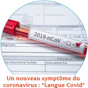 Un nouveau symptôme du coronavirus : Un nouveau symptôme du coronavirus : "Langue Covid"