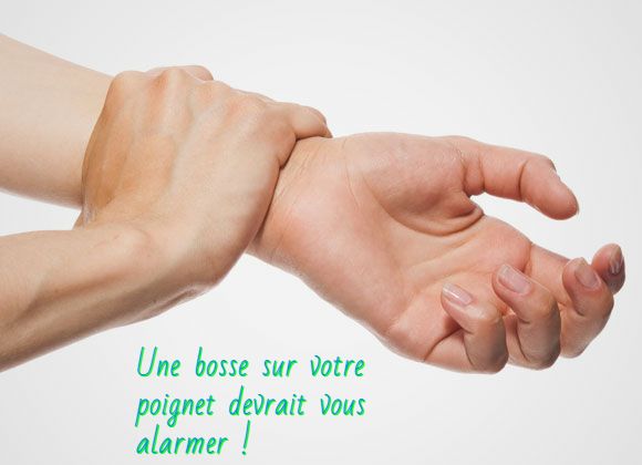 Les symptômes que vous devez garder en esprit Une bosse sur votre poignet devrait vous alarmer