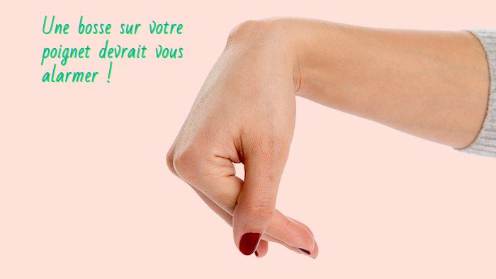Une bosse sur votre poignet devrait vous alarmer
