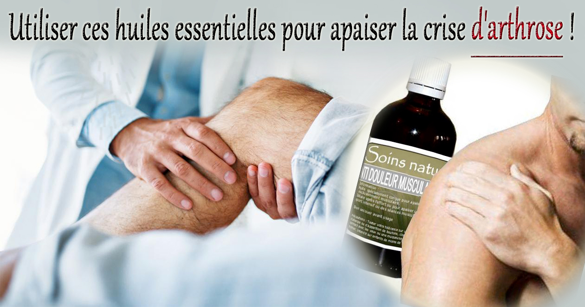 Utiliser ces huiles essentielles pour apaiser la crise d'arthrose — free download