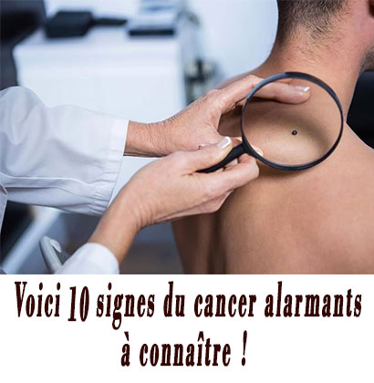 Voici 10 signes du cancer alarmants à connaître !