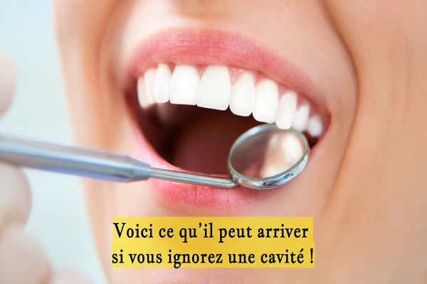 Voici ce qu’il peut arriver si vous ignorez une cavité !